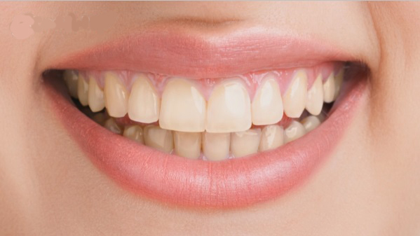 Close up on woman's smile just teeth only